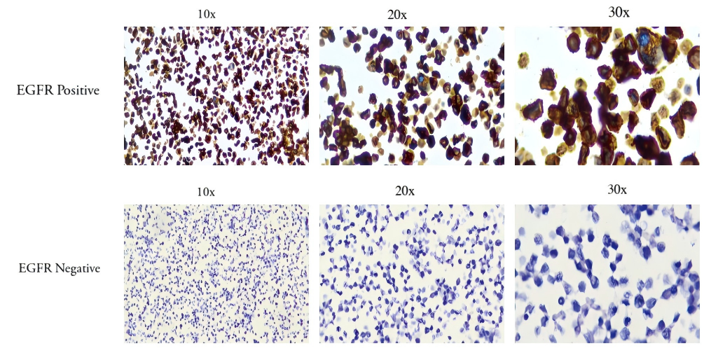 2-in-1 EGFR FFPE Slide Ref Std EGFR Positive Negative FFPE Microscope Slide Standard CBPN0019