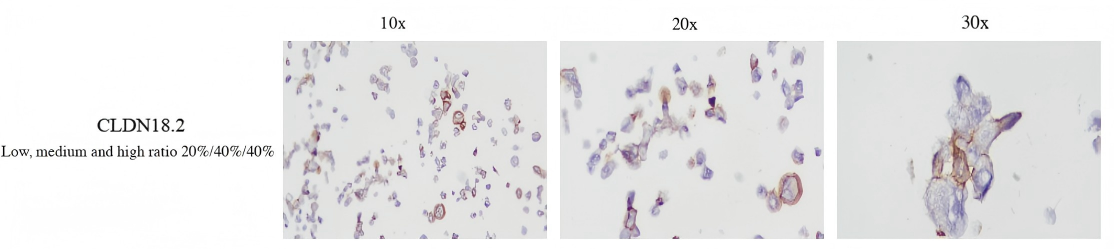 CLDN18.2 mixed FFPE Block Standard CBPN0023