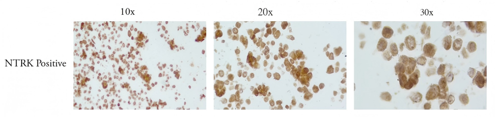 NTRK Positive FFPE Microscope Slide Reference Standard NTRK Positive FFPE Microscope Slide Standard CBPN0017