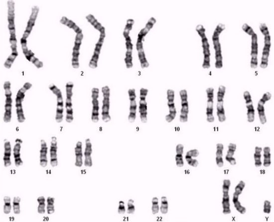 1μg Genomic DNA 47,XXY Ref Std for NIPT CBPJ0005
