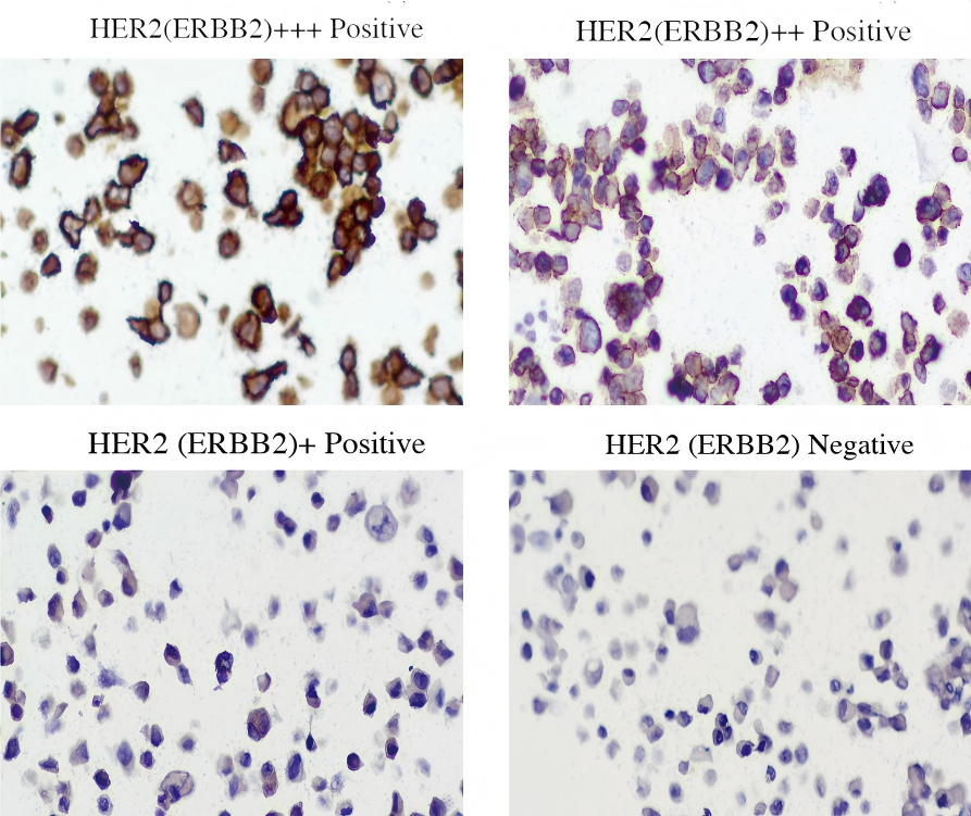 HER2 Gastric 4-in-1 FFPE Ref Std HER2 gastric 4-in-1 FFPE Microscope Slide Standard CBPN0016