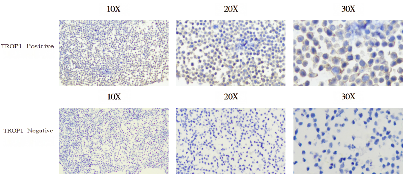 EpCAM EpCAM Positive Negative 2 in 1 FFPE Block Reference Standard