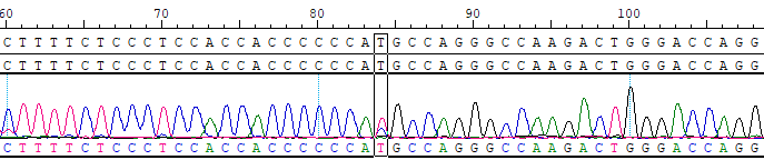 SMN1 p.M200T Reference Standard CBP10560