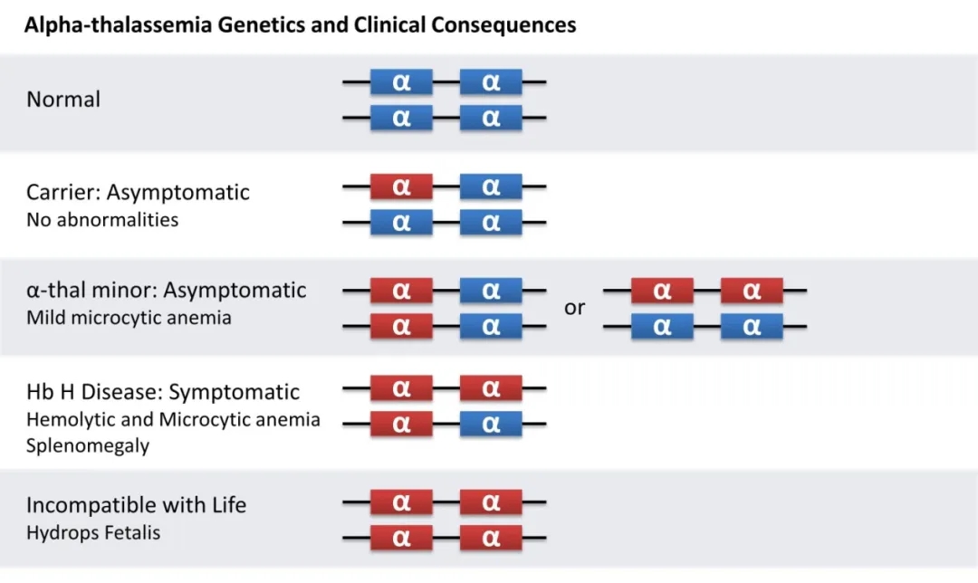 alpha-thalassemia.webp