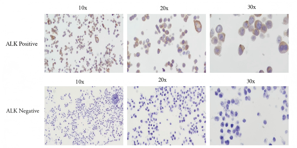 ALK Positive Negative FFPE Microscope Slide Standard CBPN0021