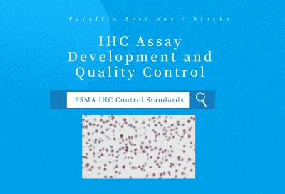 PSMA IHC Control Standards.png