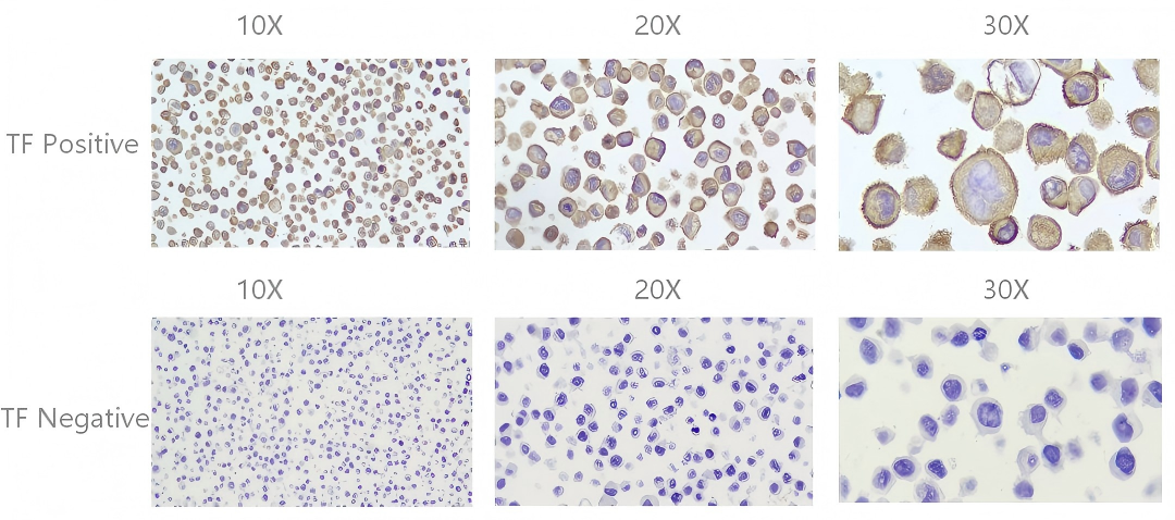 CB-Gene-TF IHC Quality Controls.png
