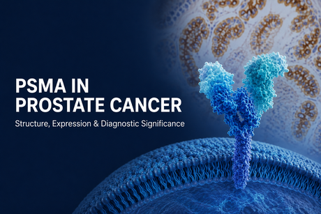 PSMA IN PROSTATE CANCER.png